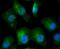 NFKB Inhibitor Beta antibody, A05766, Boster Biological Technology, Immunocytochemistry image 