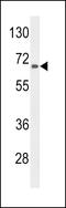 Alanine--Glyoxylate Aminotransferase 2 antibody, 64-139, ProSci, Western Blot image 