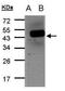 WD Repeat And FYVE Domain Containing 1 antibody, PA5-28718, Invitrogen Antibodies, Western Blot image 