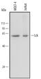 LCK Proto-Oncogene, Src Family Tyrosine Kinase antibody, AF3704, R&D Systems, Western Blot image 