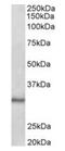 CTD Small Phosphatase 1 antibody, orb12976, Biorbyt, Western Blot image 