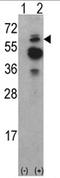 ACK1 antibody, AP17080PU-N, Origene, Western Blot image 