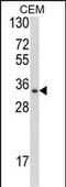 Developmental Pluripotency Associated 4 antibody, A10283-2, Boster Biological Technology, Western Blot image 