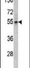 Fascin Actin-Bundling Protein 1 antibody, PA5-13696, Invitrogen Antibodies, Western Blot image 