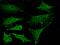 Protein Kinase N1 antibody, GTX02425, GeneTex, Immunofluorescence image 