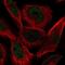 Transcription Factor AP-2 Alpha antibody, NBP2-38809, Novus Biologicals, Immunofluorescence image 