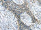Chordin Like 1 antibody, CSB-PA584727, Cusabio, Immunohistochemistry paraffin image 
