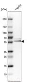 Alpha-1-antitrypsin antibody, HPA001292, Atlas Antibodies, Western Blot image 