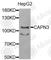 Calpain 3 antibody, A1893, ABclonal Technology, Western Blot image 