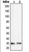 Ribosomal Protein S8 antibody, orb360719, Biorbyt, Western Blot image 