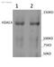 Histone Deacetylase 4 antibody, ab39408, Abcam, Western Blot image 