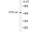 CPN1 antibody, LS-C177445, Lifespan Biosciences, Western Blot image 