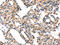 Cytochrome P450 Family 2 Subfamily D Member 6 antibody, CSB-PA051152, Cusabio, Immunohistochemistry paraffin image 