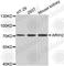 Ariadne RBR E3 Ubiquitin Protein Ligase 2 antibody, A7359, ABclonal Technology, Western Blot image 