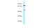 Zinc Finger Protein 354A antibody, ARP49648_P050, Aviva Systems Biology, Western Blot image 