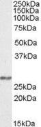 NADH:Ubiquinone Oxidoreductase Core Subunit S3 antibody, GTX88423, GeneTex, Western Blot image 