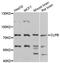ClpB Homolog, Mitochondrial AAA ATPase Chaperonin antibody, STJ113616, St John