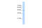 Cholinergic Receptor Nicotinic Beta 2 Subunit antibody, 28-226, ProSci, Western Blot image 