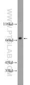 DNA Polymerase Delta 3, Accessory Subunit antibody, 21935-1-AP, Proteintech Group, Western Blot image 