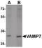 Vesicle Associated Membrane Protein 7 antibody, PA5-34405, Invitrogen Antibodies, Western Blot image 