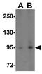 TNF Alpha Induced Protein 3 antibody, GTX31378, GeneTex, Western Blot image 