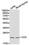 Inducible T Cell Costimulator antibody, LS-C192964, Lifespan Biosciences, Western Blot image 