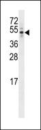 Centrosomal Protein 44 antibody, PA5-48999, Invitrogen Antibodies, Western Blot image 