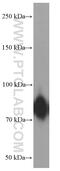 Coagulation Factor XIII A Chain antibody, 66325-1-Ig, Proteintech Group, Western Blot image 