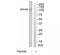 EPH Receptor A2 antibody, TA313799, Origene, Western Blot image 