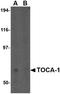 Formin Binding Protein 1 Like antibody, NBP1-76846, Novus Biologicals, Western Blot image 