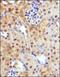 Solute Carrier Family 2 Member 9 antibody, NBP1-05054, Novus Biologicals, Immunohistochemistry paraffin image 