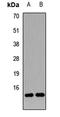 Neurogranin antibody, LS-C667929, Lifespan Biosciences, Western Blot image 