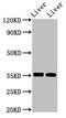 Arginase 1 antibody, CSB-PA002005DA01HU, Cusabio, Western Blot image 