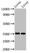 Liver-type arginase antibody, CSB-PA002005DA01HU, Cusabio, Western Blot image 