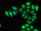 RNA Binding Motif Protein 38 antibody, LS-C679296, Lifespan Biosciences, Immunofluorescence image 