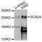 Sodium Voltage-Gated Channel Alpha Subunit 2 antibody, abx126513, Abbexa, Western Blot image 