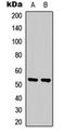 Serum/Glucocorticoid Regulated Kinase 1 antibody, orb304580, Biorbyt, Western Blot image 