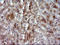 Group XVI phospholipase A2 antibody, LS-C797765, Lifespan Biosciences, Immunohistochemistry paraffin image 