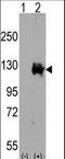 Transient Receptor Potential Cation Channel Subfamily M Member 8 antibody, LS-C100966, Lifespan Biosciences, Western Blot image 