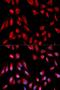 Hydroxysteroid 17-Beta Dehydrogenase 10 antibody, LS-C334066, Lifespan Biosciences, Immunofluorescence image 