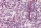 Spi-1 Proto-Oncogene antibody, MBS247864, MyBioSource, Immunohistochemistry paraffin image 