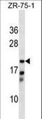 Carbonyl Reductase 4 antibody, LS-C159273, Lifespan Biosciences, Western Blot image 