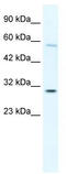 GATA Zinc Finger Domain Containing 1 antibody, TA331797, Origene, Western Blot image 