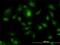 Hepatocyte Growth Factor-Regulated Tyrosine Kinase Substrate antibody, H00009146-M01, Novus Biologicals, Immunocytochemistry image 