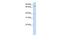 Chromosome 17 Open Reading Frame 80 antibody, GTX46313, GeneTex, Western Blot image 