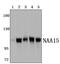N(Alpha)-Acetyltransferase 15, NatA Auxiliary Subunit antibody, PA5-75957, Invitrogen Antibodies, Western Blot image 