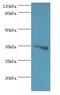 Glycine-N-Acyltransferase Like 1 antibody, LS-C378426, Lifespan Biosciences, Western Blot image 