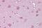 Norrin Cystine Knot Growth Factor NDP antibody, PA5-44481, Invitrogen Antibodies, Immunohistochemistry frozen image 