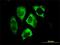 Parkin RBR E3 Ubiquitin Protein Ligase antibody, H00005071-M01, Novus Biologicals, Immunofluorescence image 