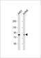 Diacylglycerol Kinase Alpha antibody, 63-409, ProSci, Western Blot image 